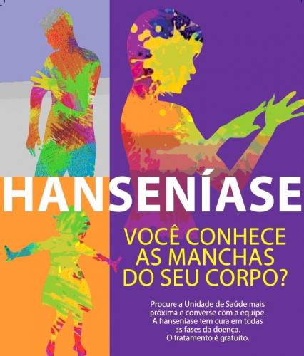Hanseníase